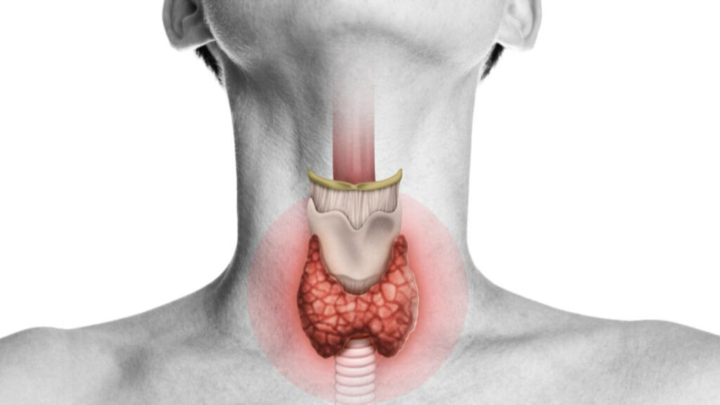 Sering Diabaikan! 5 Makanan Ini Diam Diam Jaga Fungsi Tiroid Tetap Optimal